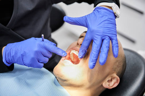 Best Broken Tooth Emergency  in Scarsdale, NY